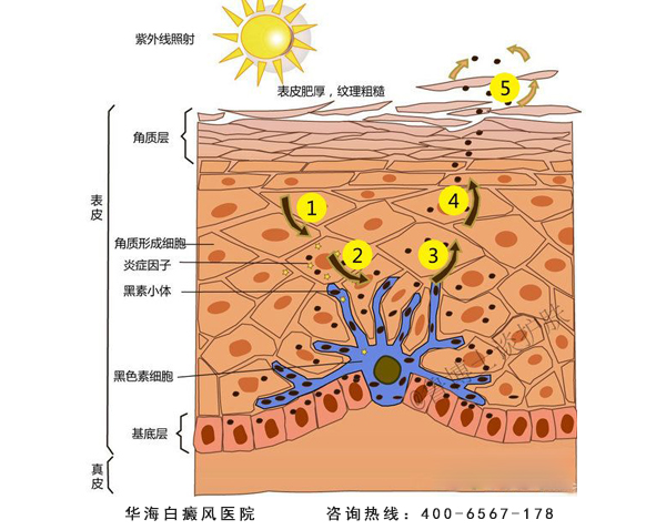 黑素细胞