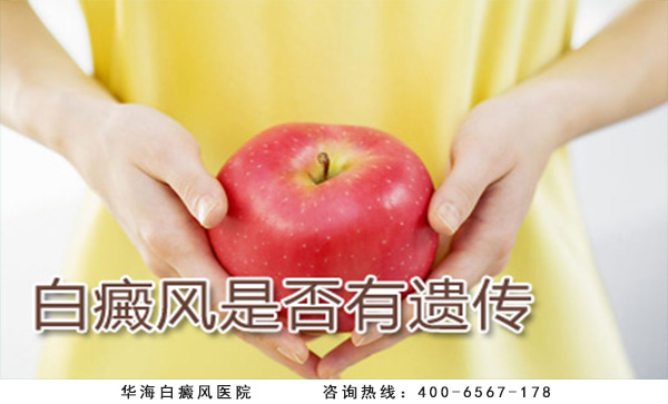 白癜风遗传 白癜风遗传