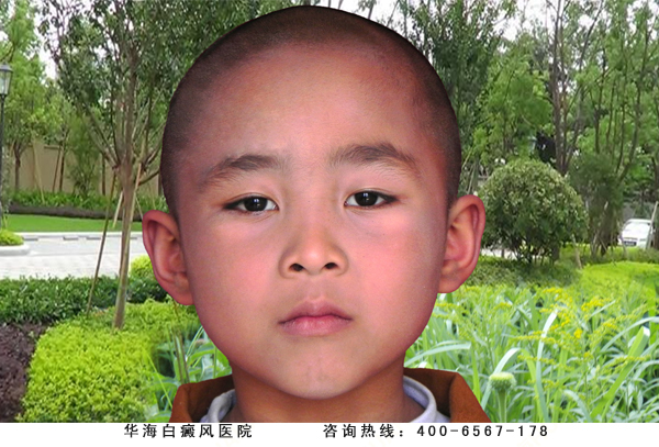 张国豪（邹平），他的父亲张前进一人养活一家八口，为给儿子治病感动乡里