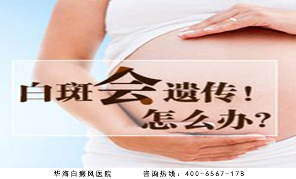 白癜风遗传