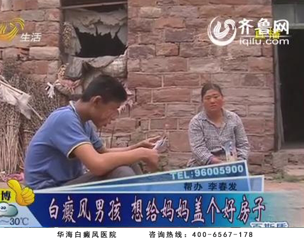 白癜风男孩牛传明接受《生活帮》采访