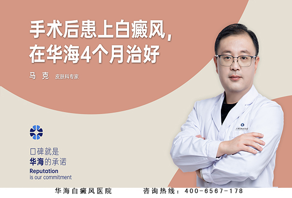 白癜风诱发因素.jpg