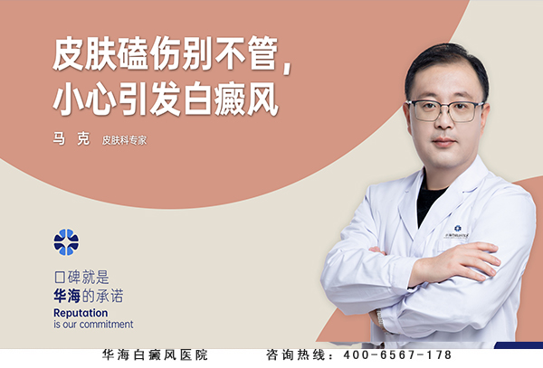 白癜风诱因.jpg
