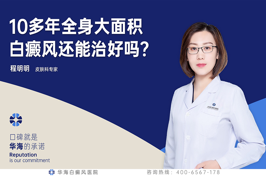 大面积白癜风.jpg