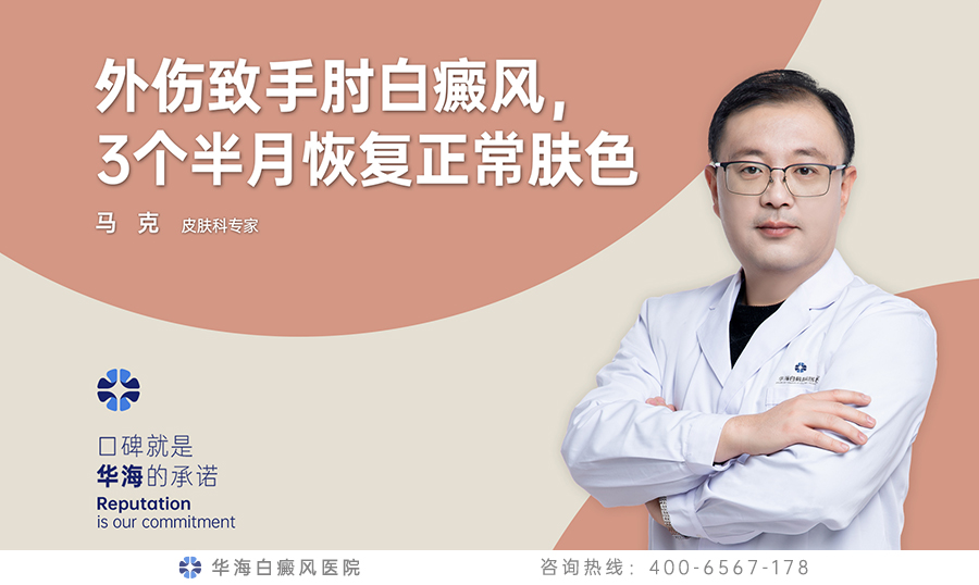 肢端白癜风.jpg