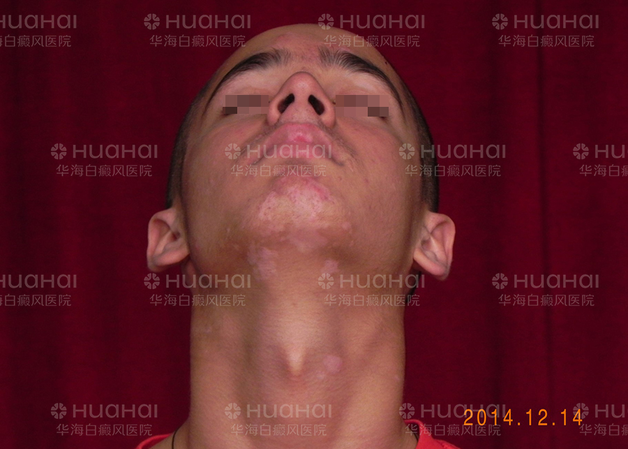 1721547463509284.jpg 哈萨900-1.jpg