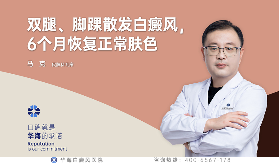 肢端白癜风.jpg